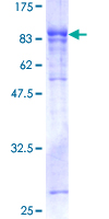 12.5% SDS-PAGE Stained with Coomassie Blue.